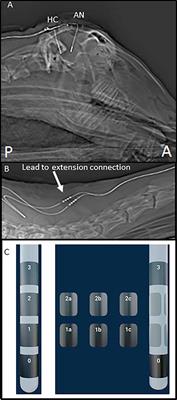 Long Term Performance of a Bi-Directional Neural Interface for Deep Brain Stimulation and Recording